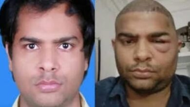 Kanpur: Another engineer dies in the desire of having thick hair, same doctor accused again