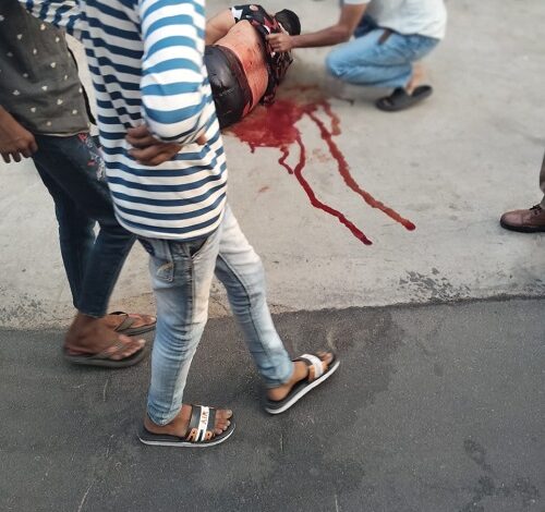 Bullets echoed again in the capital: Young man shot in the chest in Ghazipur, admitted to Lohia Hospital