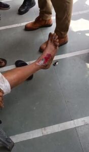 Rakabganj: Minor e-rickshaw driver injured passengers, questions raised on illegal operation